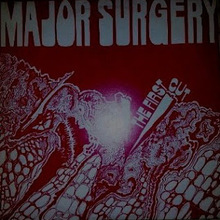 Major Surgery